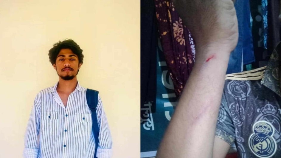 কুবিতে এক শিক্ষার্থীকে মারধরের অভিযোগ ছাত্রদল কর্মীর বিরুদ্ধে