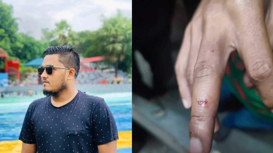 বাসে উঠা নিয়ে জুনিয়রের হাতে কামড় দিলো সিনিয়র