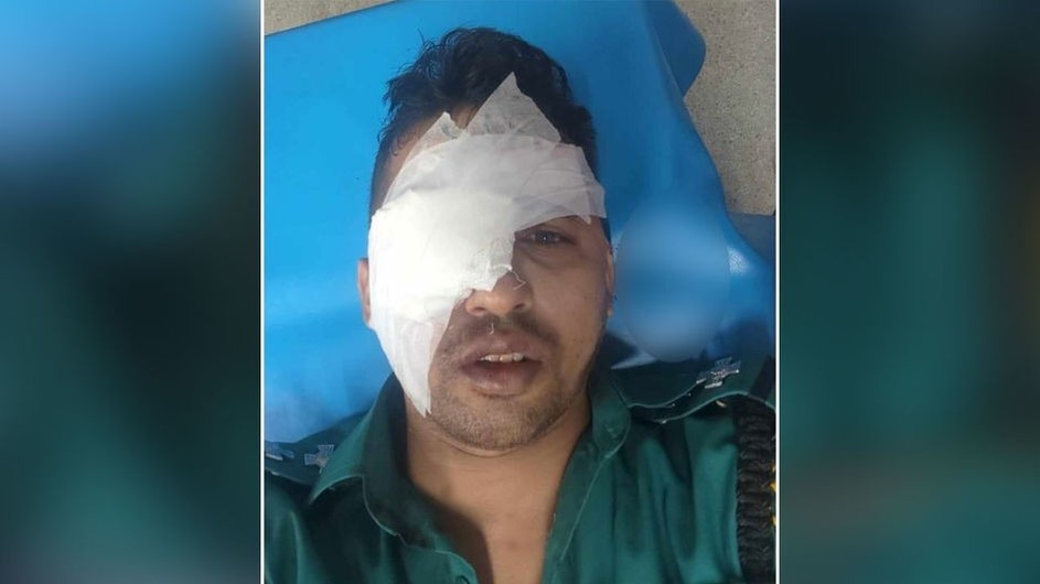 হিজড়াদের হামলায় চোখ হারালেন পুলিশের এসআই