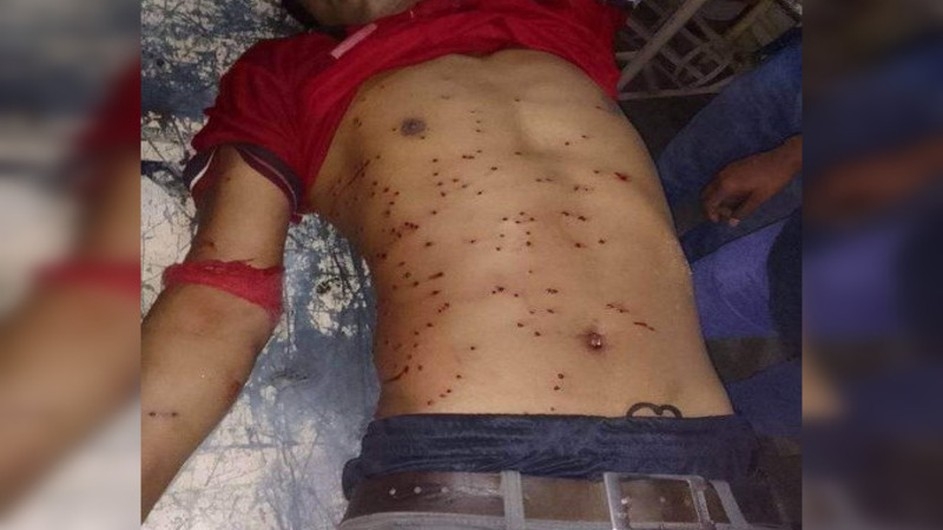 রাবি শিক্ষার্থীদের ছত্রভঙ্গ করতে পুলিশের টিয়ারশেল নিক্ষেপ